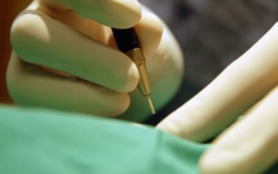 Χειρουργική αντιμετώπιση της καλοήθους υπερπλασίας του προστάτη