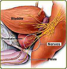 nevra-stisis